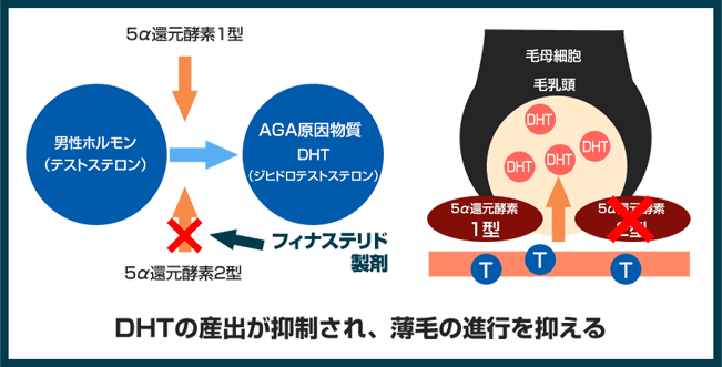 抑制 ジヒドロ テストステロン